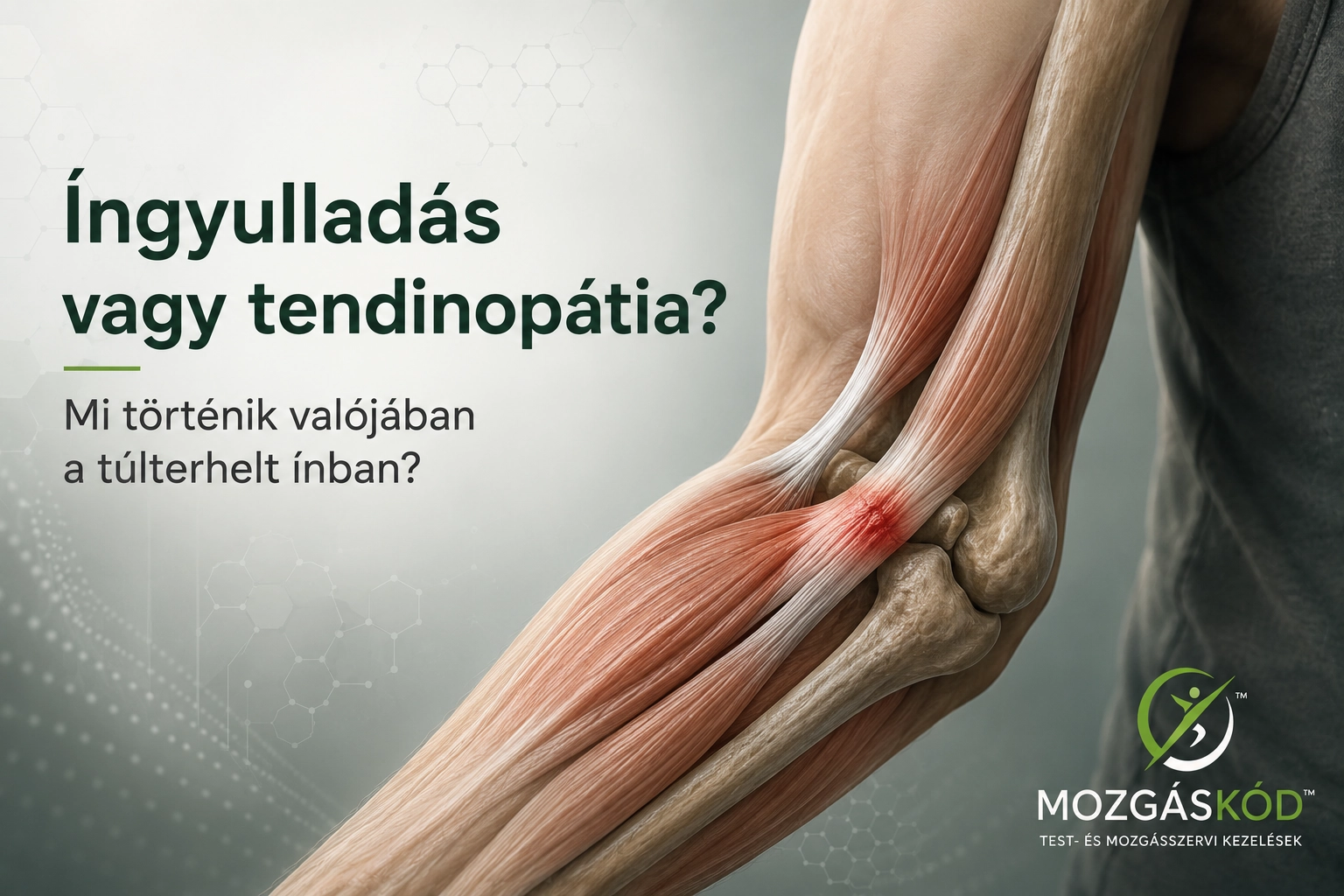 Íngyulladás vagy tendinopátia – túlterhelt ín anatómiai szemléltetése
